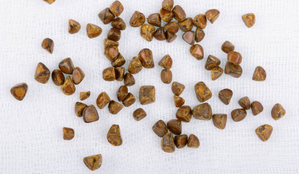 Top view of gallbladder stones on white background